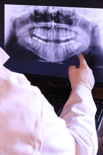Best Emergency Wisdom Tooth Extraction in West Valley City, UT